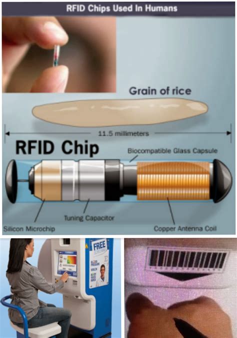 are rfid chips mandatory|microchip implants banned.